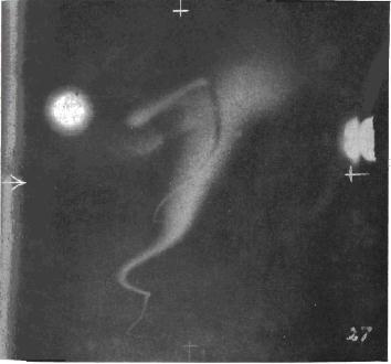 Figure 9. Photogrpah of sodium vapor cloud taken 500 seconds after the rocket launching, Palayamkottai, 21 November 1963.