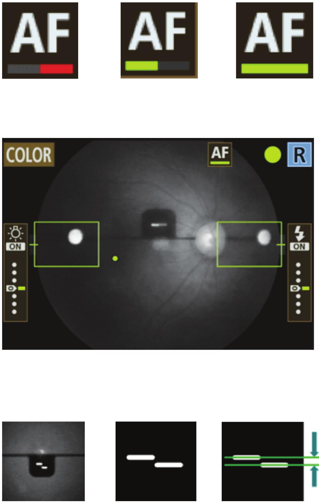 AUTO functionality New! CONTRAST ENHANCEMENT Affords increased image clarity by emphasizing the differences in redness and brightness of blood vessel structures relative to their surroundings.