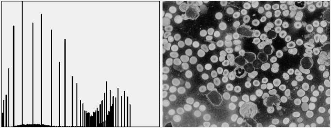 nuclei part of the white blood cells. Figure (5) is shown the resulted I 3 -image after enhancing with I3-histogram.
