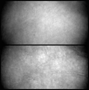 Fig. 11. Four-burst videos (top) without and (bottom) with adaptive compensation of a network of retinal capillaries at 1.4 eccentricity in subject RJ. The size of the retinal patch is 1 by 1/2 deg.