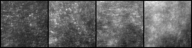 exposures of 33 msec (middle right) and 100 msec (rightmost), cone quality is significantly worse and in many frames is essentially lost suggesting that retina motion blur is the limiting factor.
