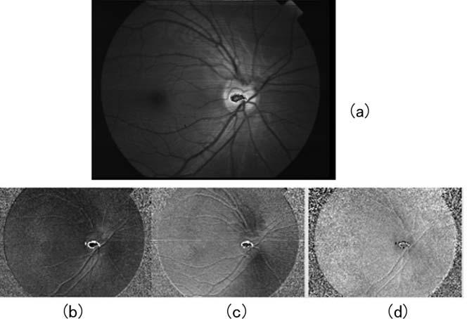 Fig. 5 Data sample of right eye of a 29-year old woman. (a) Image taken with polarization analysis camera. Distribution maps of Stokes parameter (b) S1, (c) S2, and (d) S3.