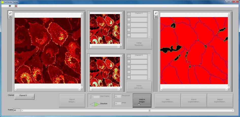 The result of the interactive segmentation will appear in the segmentation window on the right. 3.