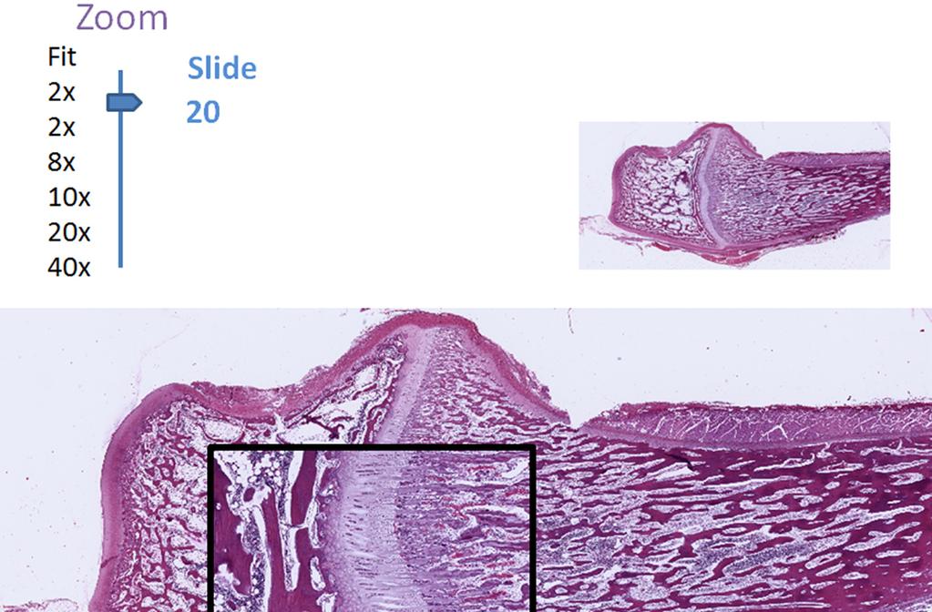 Fig. 2. Digital slide of bone formation accessed with Image Scope.