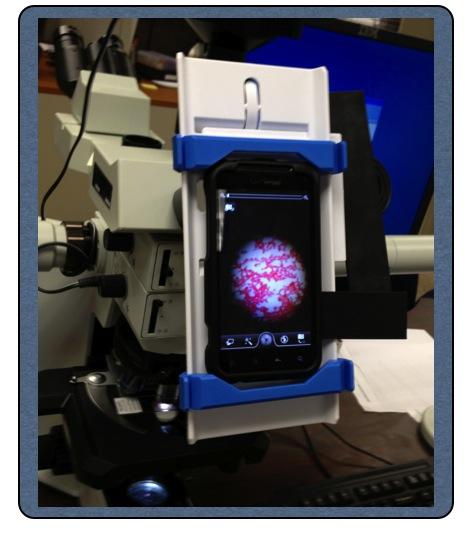These images can be uploaded to our server directly from the smartphone by using the mobile version of the UPMC Digital Pathology Consultation portal, at https://pathconsult.upmc.