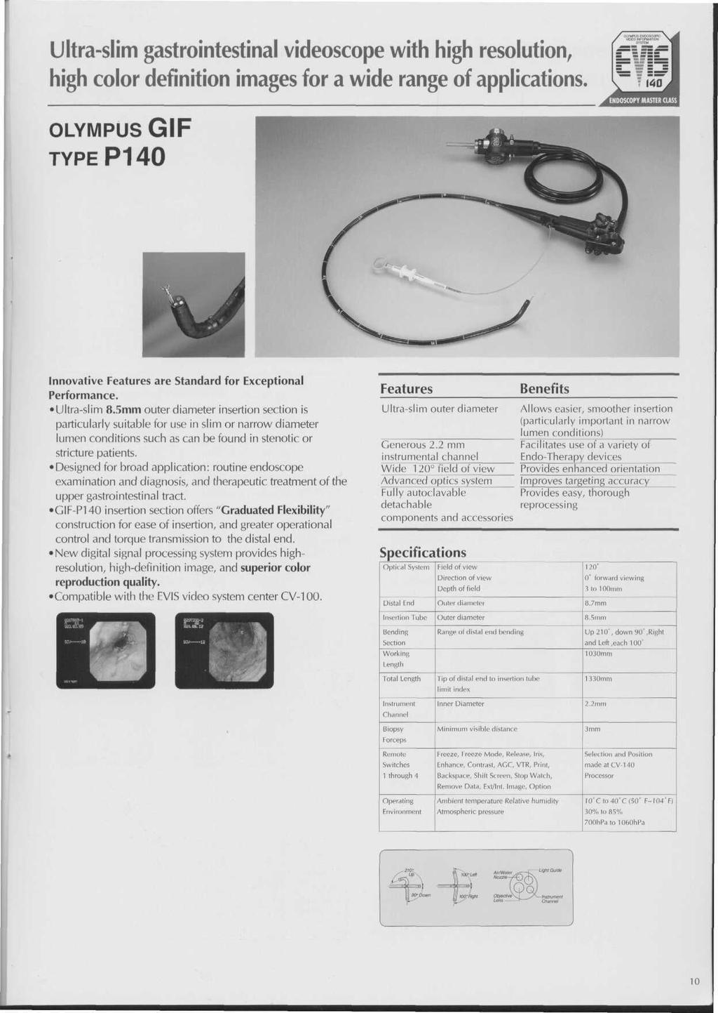 Ultraslim gastrointestinal videoscope with high resolution, high color definition images for a wide range of applications.