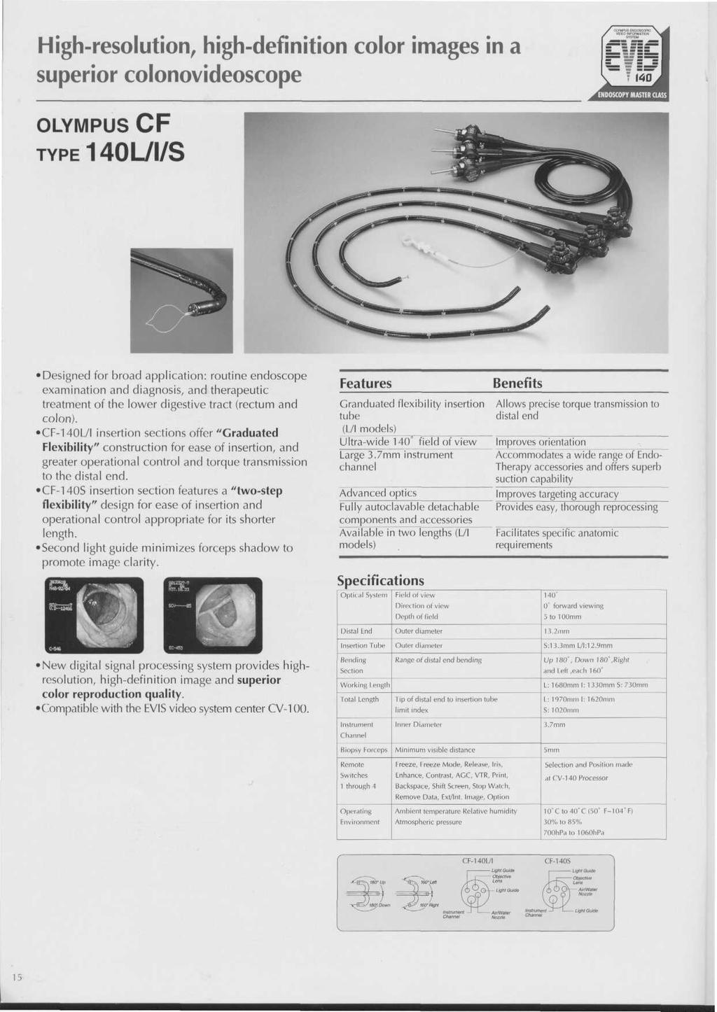 Highresolution, highdefinition color images in a superior colonovideoscope ENDOSCOPY MASTER CLASS OLYMPUS CF TYPE140L/I/S Designed for broad application: routine endoscope examination and diagnosis,
