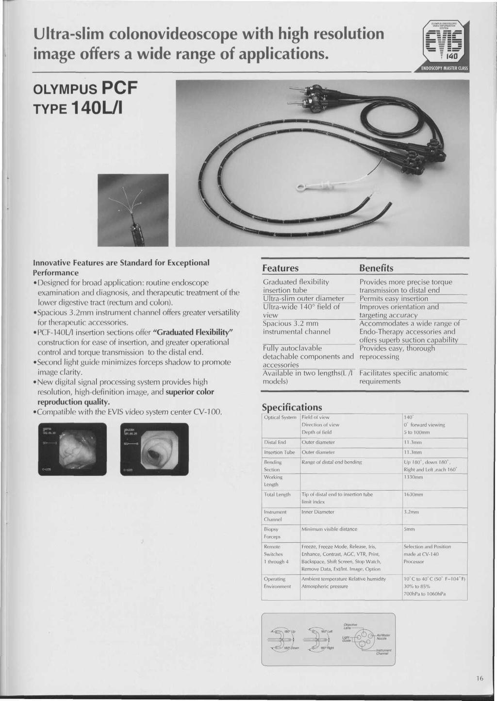 Ultraslim colonovideoscope with high resolution image offers a wide range of applications.