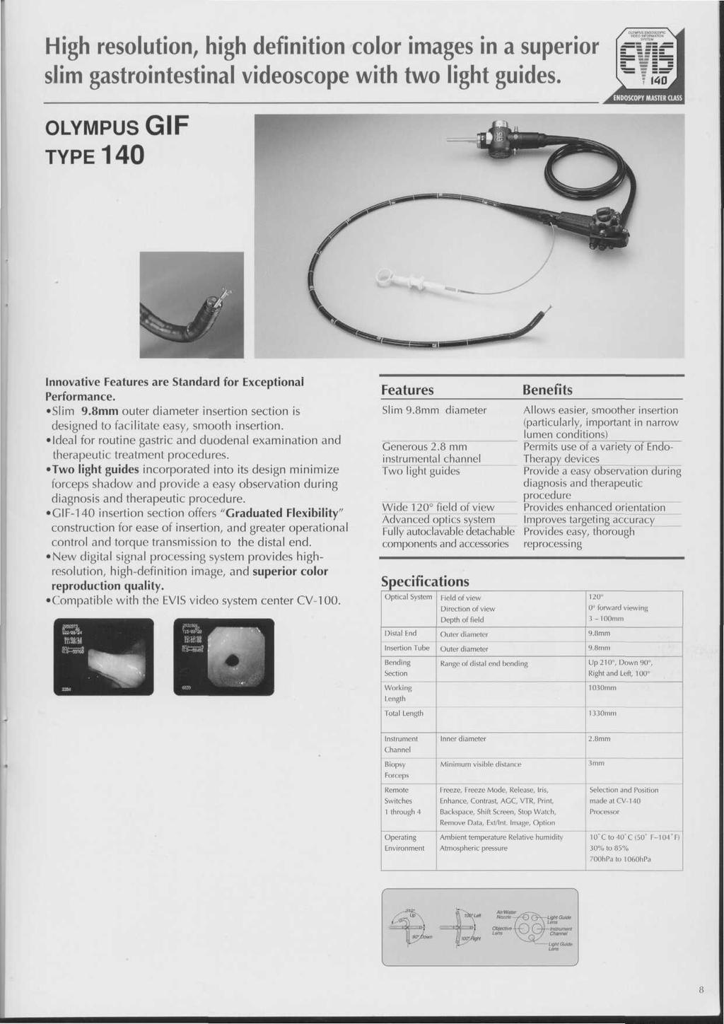 High resolution, high definition color images in a superior slim gastrointestinal videoscope with two light guides. OLYMPUS GIF TYPE 140 Innovative Features are Standard for Exceptional Performance.