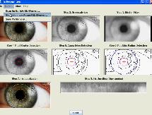 Conclusion In this work, the explored method of creating iris code for a given person embedded in their natural iris texture.
