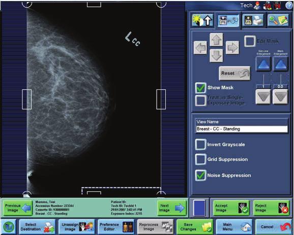 1. On the CR System monitor, or the ROP display, make sure that a thumbnail image is present on the Patient Input Screen for each cassette scanned.