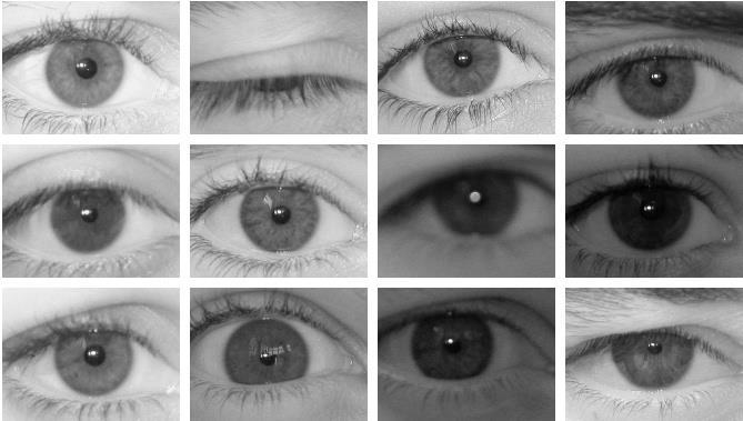 The first step of the iris identification system is image acquisition. This step is very complicated because the size and color of iris of every person is different.