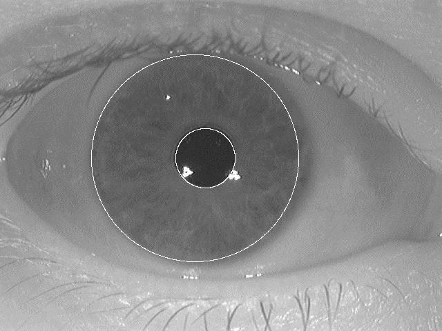 Segmentation Segmentation is also known as Localization. The first stage of iris recognition is to isolate the actual iris region in a digital eye image.