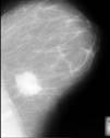 Pseudocolour Image Processing in Digital Mammography Fig.
