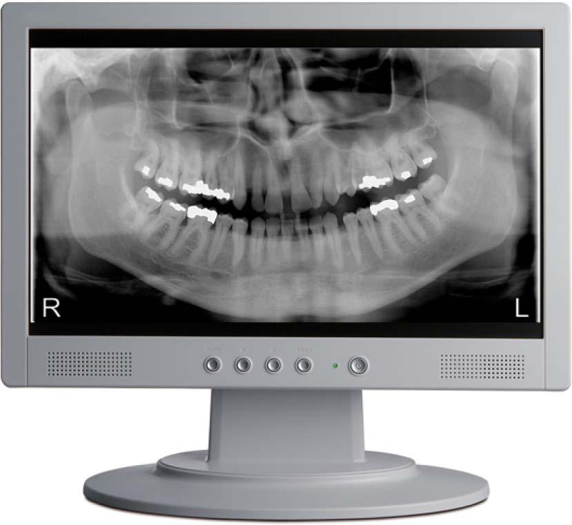 1. INTRODUCTION 1.1 Purpose ART Plus is a dental panoramic digital imaging system utilizing the latest CdTe-CMOS technology.