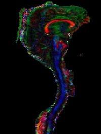Tractography