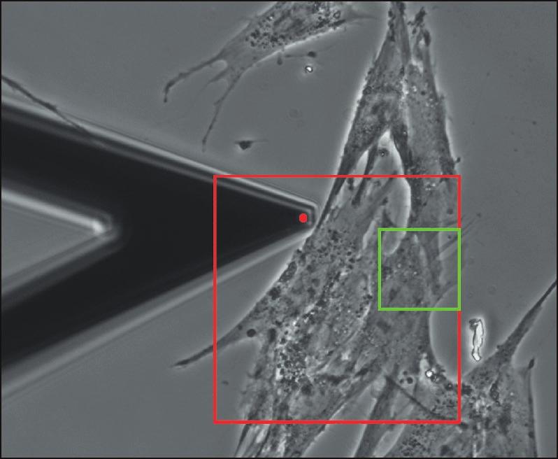 40X phase contrast image of MRC-5 fibroblasts on a Petri dish.