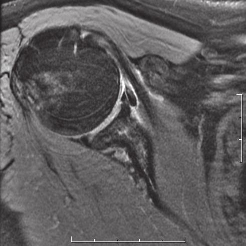 Knee imaging with the 18-channel coil has also been put to the test. Dr.