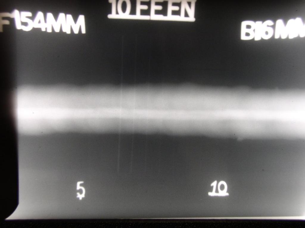 Radiograph no 7: 155 mm focus to object distance and 16mm object to film distance.