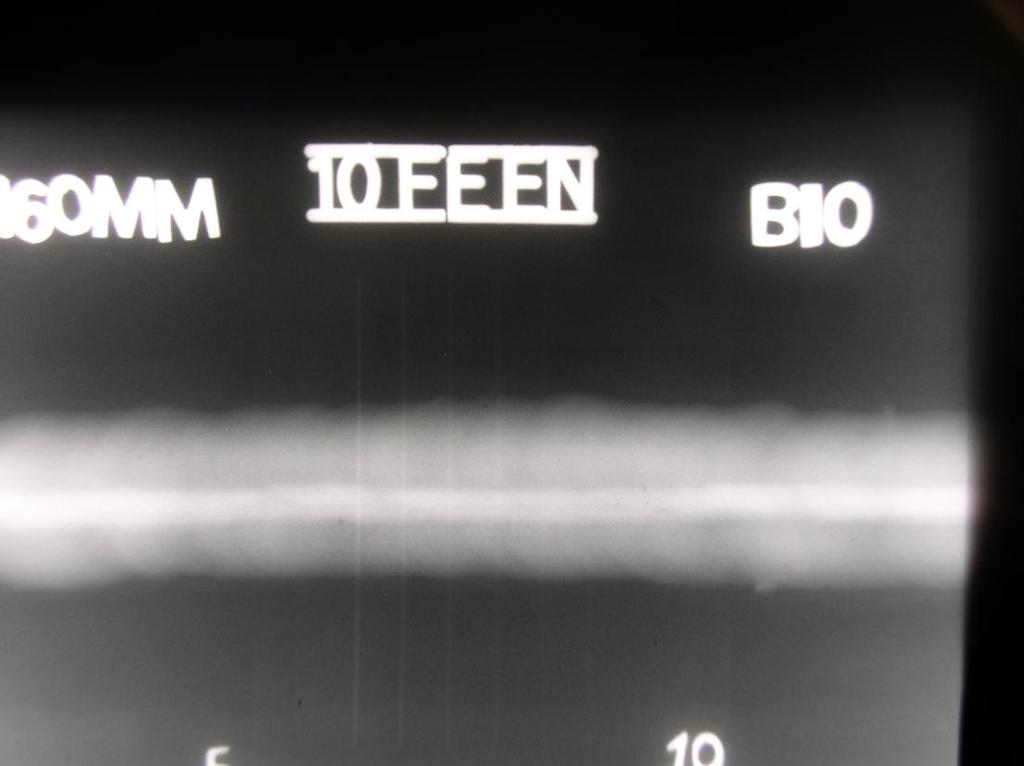 Radiograph no 8: 160 mm focus to object distance and 10mm object to film distance.