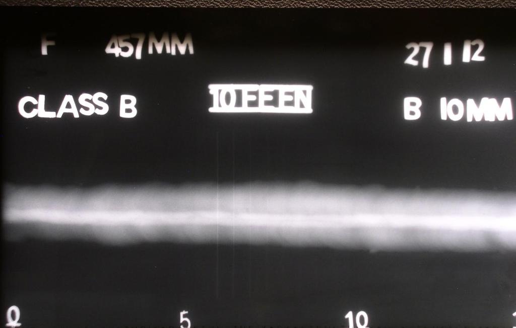 Radiograph no 10: 475 mm focus to object distance and 10mm object to film distance.