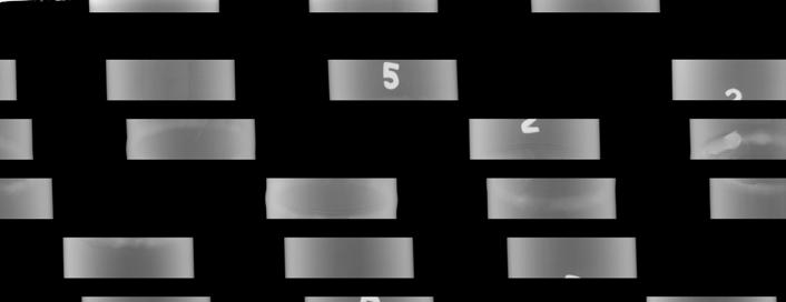 Figure 04.C: Median filtered noise free radiograph. 6.0 Summary Computed Radiography uses image receptors with barium fluoro-halide screens that function quite differently from normal film radiograph.