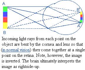 This figure shows how a lens that bends light can focus the light from each point in the environment on a specific part of the retina.