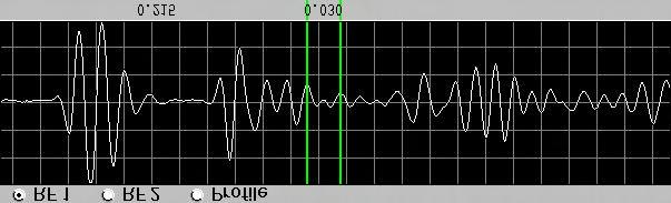 A-Scan in area of bonded solder bump. A-Scan in area of defective solder bump. Figure 5 - Example of 100 MHz A-Scans using the loss of back wall echo method.