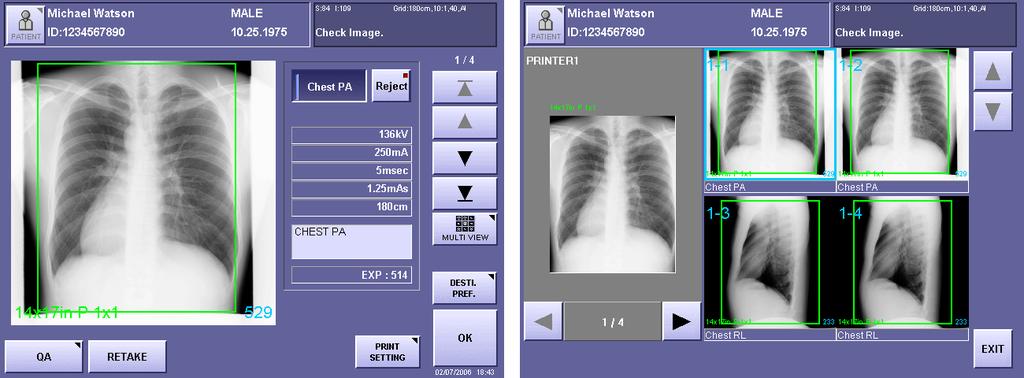 2. Taking an Image To refer to other images for the current patient Touch the preview image button to display the preview image screen, or touch [MULTI VIEW] to display the multi-view screen ( page