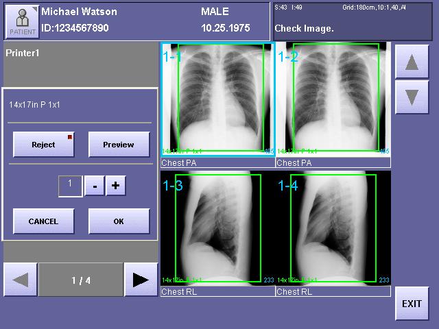 5. Viewing Multiple Images (Multi-View Screen) 5.3 Window Operations When an image on the right side of the screen is touched directly, the window will open and various operations can be performed.