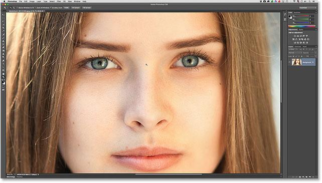 With the Zoom Tool selected, click a few times on the area between the eyes (the upper nose area) so we're zooming in on both eyes at once.