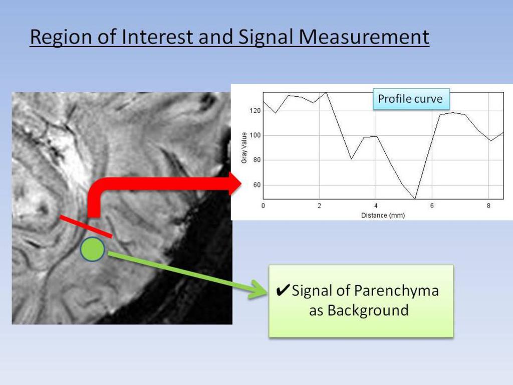 Fig. 4: Contrast was defined by lowest signal of transverse profile curve of OR (red line).