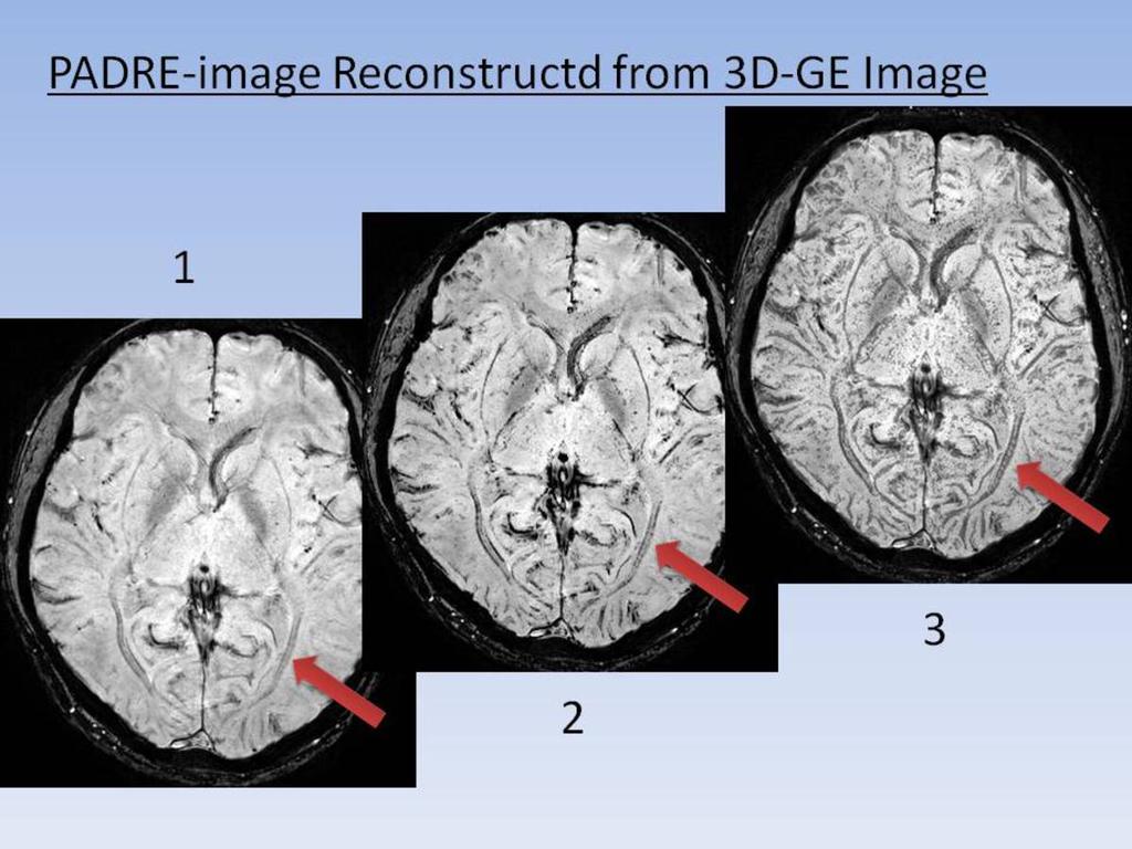 Fig. 2: All of images show high contrast of OR which is pointed by red arrow.