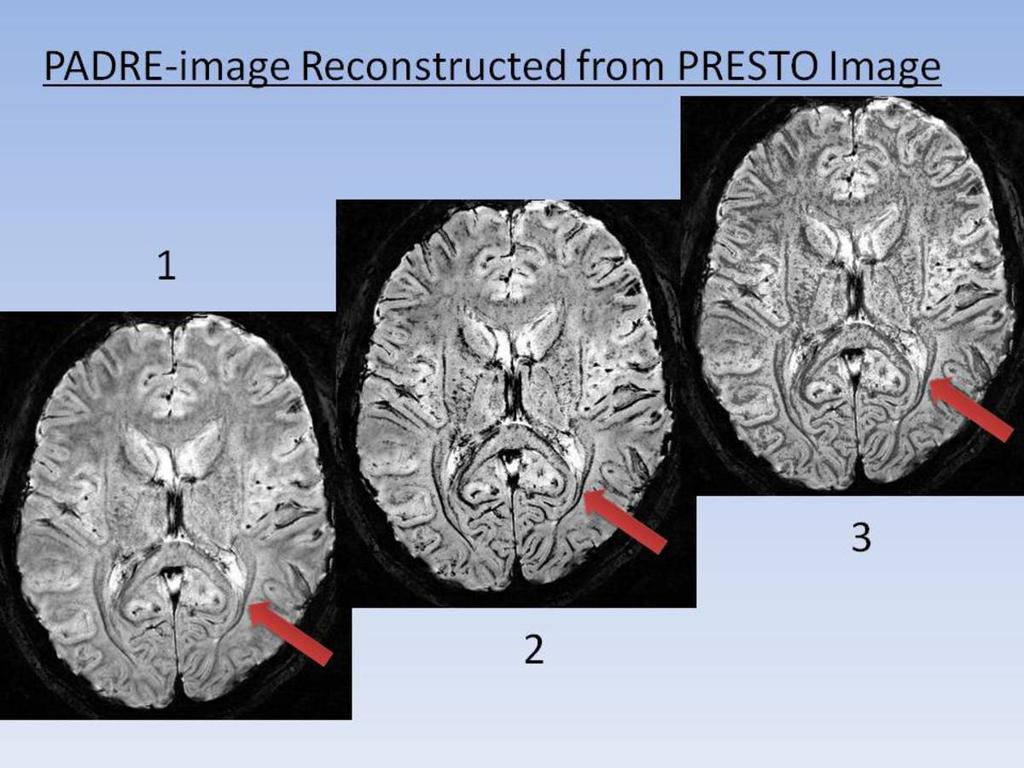 Fig. 3: Enhanced Images generated from PRESTO images.
