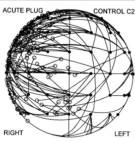 Binaural vs Monaural Localization Listeners locate well broadband sounds in both azimuth and elevation when binaural, as well as monaural, sound