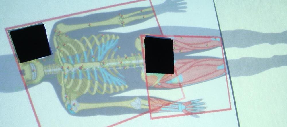 The neurosurgeon overlays her lens (Figure 12(b)) on the orthopedic surgeon s lens to acquire an overlapped image (Figure 12(c)).