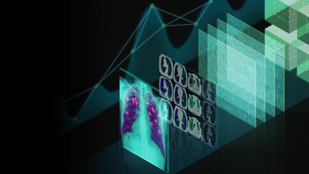 THE BRAIN OF AI HEALTHCARE AI is transforming the spectrum of healthcare, from detection to diagnosis to treatment.