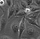 10X Phase Contrast of HeLa Cells: Time- Lapse for 10
