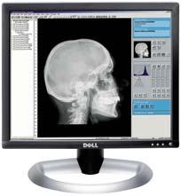 Patient demographic data can be transferred directly from RIS/HIS via DICOM Worklist while all exposure and image processing parameters can be chosen with a few touch screen selections.