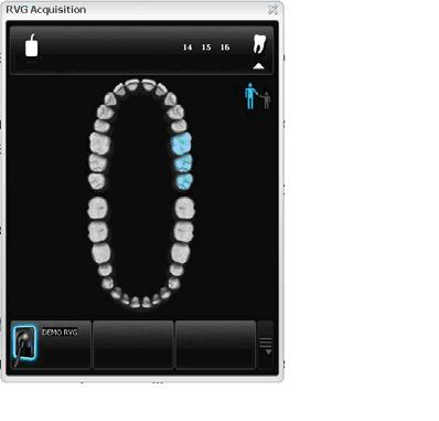 Figure 5 Dental Arch for Tooth Selection The Dental Arch enables you to select the