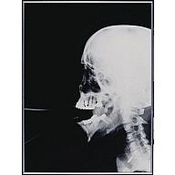 09. X-Ray X-Ray 1991 Gelatin silver print