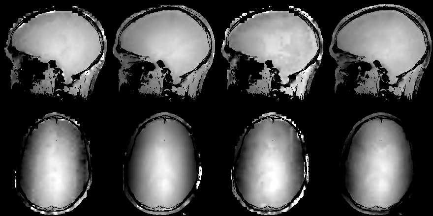 53 1.2 0.8 Figure 2.5: Flip angle maps for a sagittal (top row) and axial (bottom row) in the head at 3T. From left to right the methods of acquisition are intdall, nidall, DτLL and AFI.