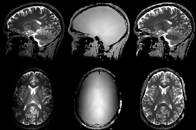 54 3500, 1.2 1900, 0.8 300, 0.4 Figure 2.6: Sagittal (top row) and axial (bottom row) T 1 and flip angle maps in the head.
