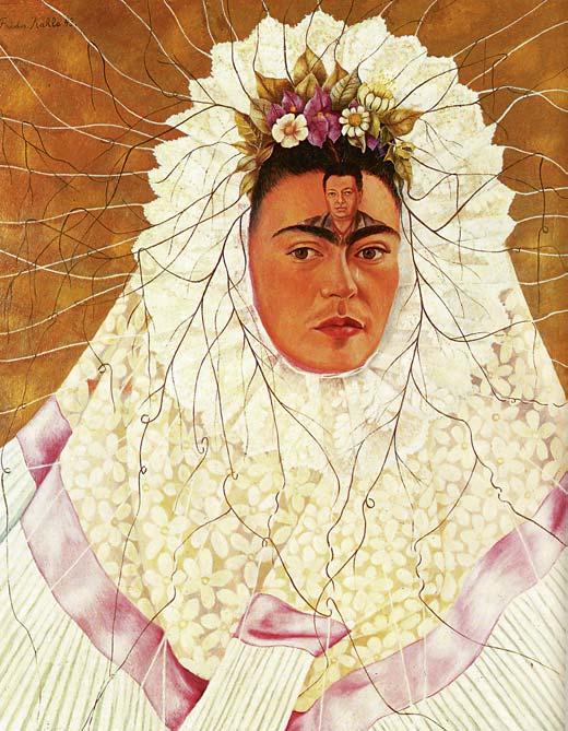 RSD usually develops within days or months after even minor traumatic tissue injury, bone fracture, surgical intervention or prolonged immobilization, and Frida Kahlo had experienced them all.