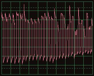 The waveform shown here is from humming into the microphone, notice how the tops of the pulses show a regular pattern of dips now. Look ahead to the Microphone project PC14 on page?