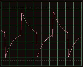 The oscilloscope waveforms shown on your display may appear upside down ( inverted ) from those shown throughout this document.