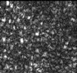 We think that our inability to clearly resolve the rod photoreceptor mosaic is due to the creation of speckle by the coherent detection nature of OCT.