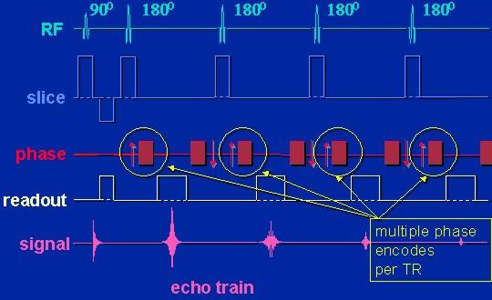 Multi Echo Spin Echo RF only 1 phase encode per TR ST = TR(msec) x Npe x NEX /60,000(msec) slice ST: Scan time in minutes Npe: Number of phase steps NEX: Number of