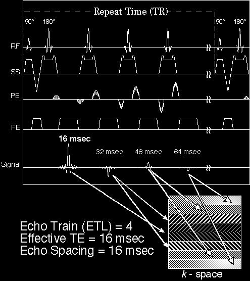 with Relaxation Enhancement) method. 192 192 A 90 pulse initiates the sequence, followed by multiple 180 pulses to generate multiple echoes.
