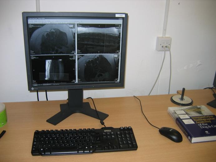 Computed radiography